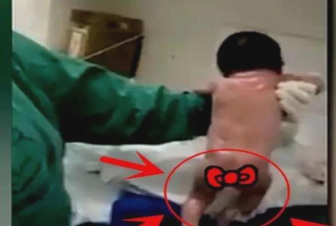 比分直播-"最猛新生儿"走红!带着脐带站起来就想跑,医生险些都没能抓住